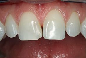 Willow Ridge Dental Care | Teeth Whitening, Periodontal Treatment and Digital Impressions